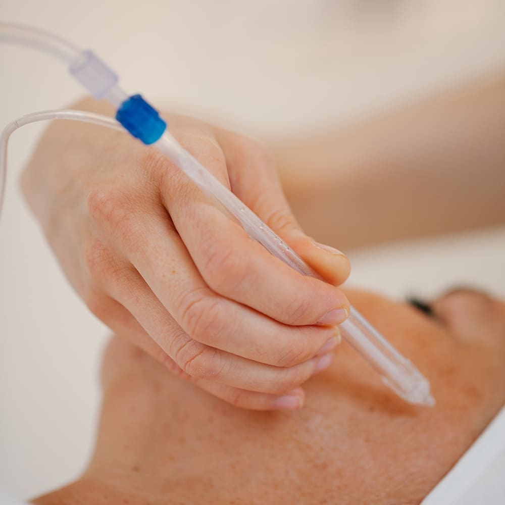 How does the JetPeel technology work?