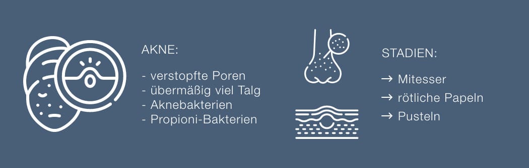 Informationen zu Akne-Typen