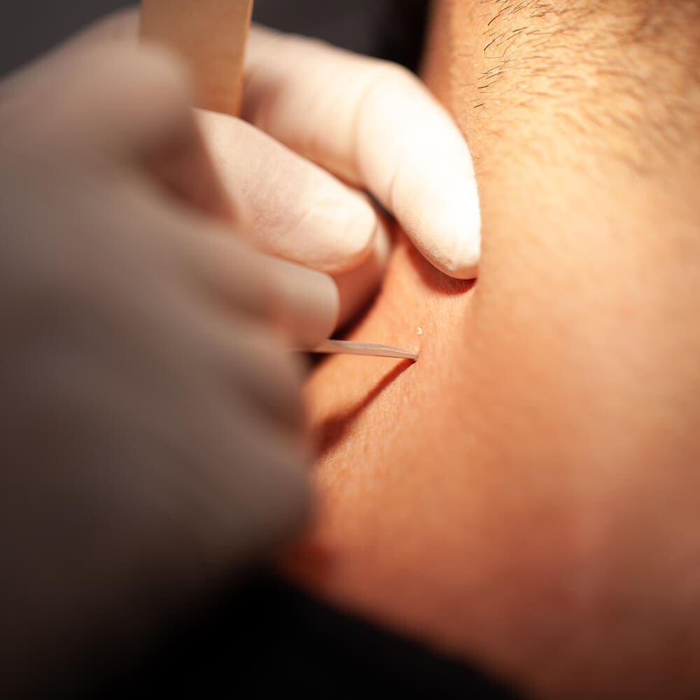 Your skin is unique!