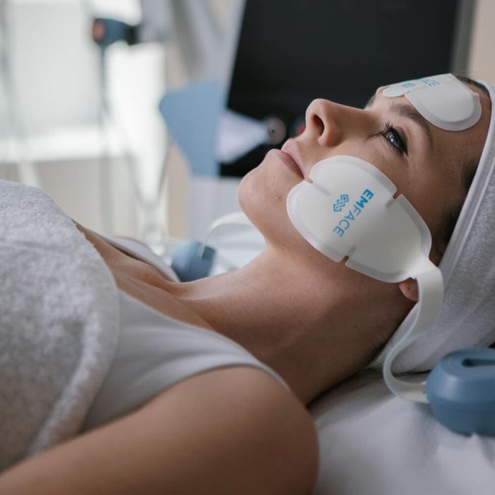 EMFACE bei Volumenverlust: Muskelaufbau statt „Pillowface“