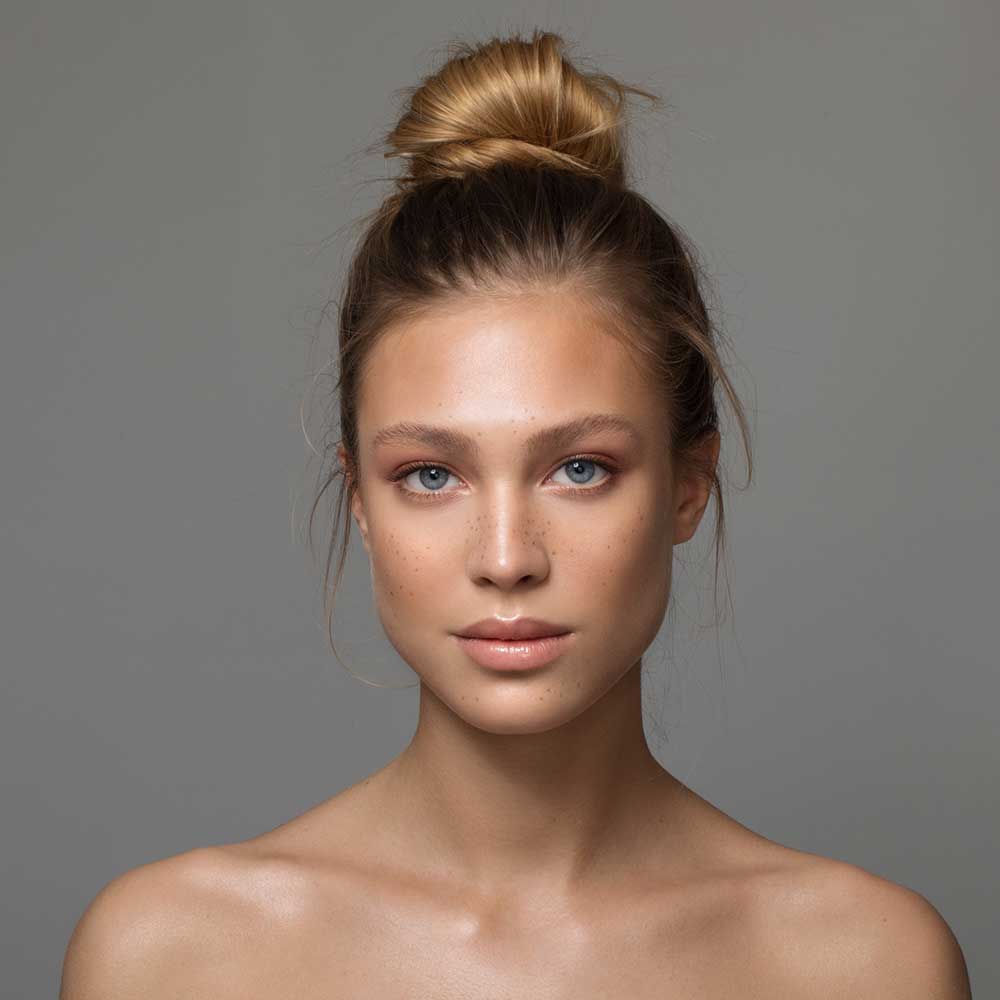 What are fruit acid peels?